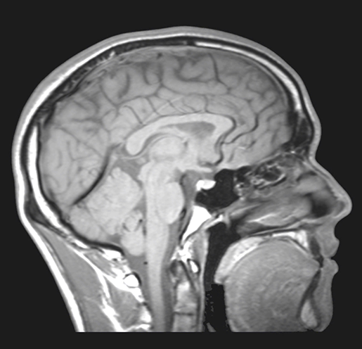 sports-injuries-midsagittal-slice-mri